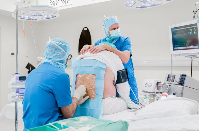 Epidural Anesthesia