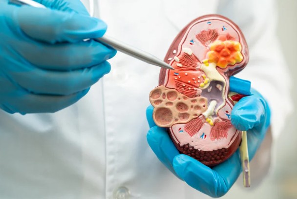 Kidney & Urine Disorders